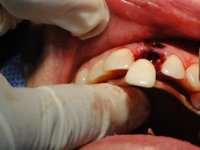 Porast dentalnog turizma u Hrvatskoj
